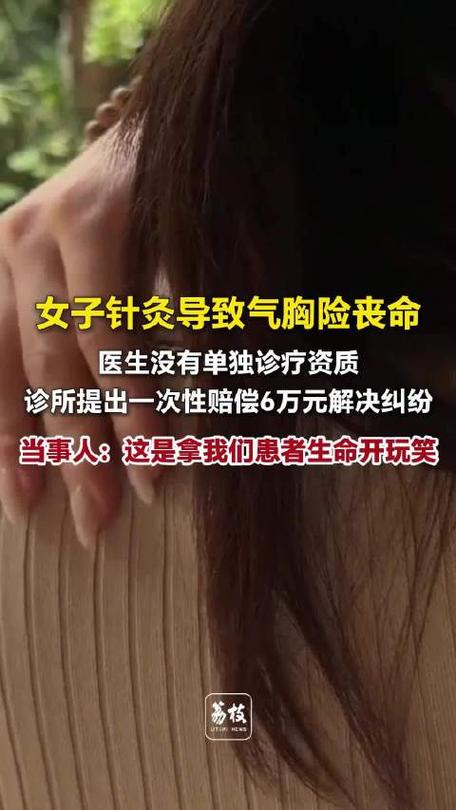 女子针灸导致气胸险丧命