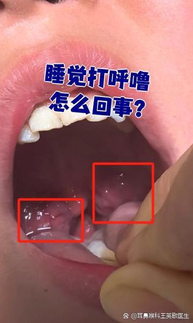 手机怎么录打呼噜