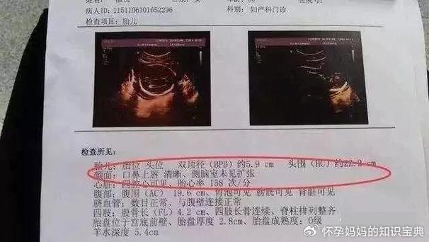 彩超3个月男女辨别图