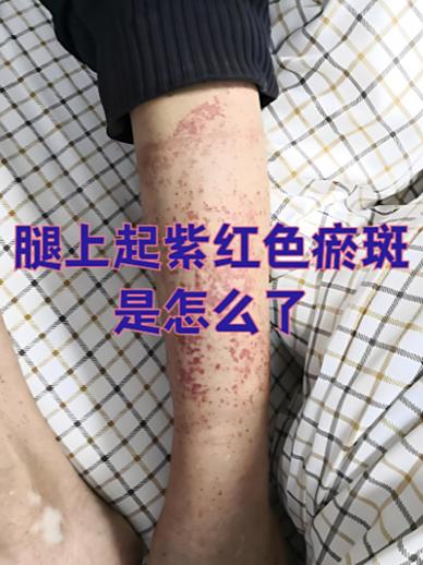 磕碰的痕迹怎么消除