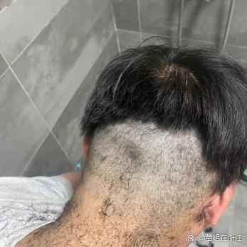被医生男友要求剃头截图