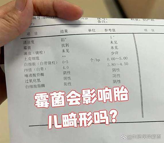 霉菌一个加号严重吗