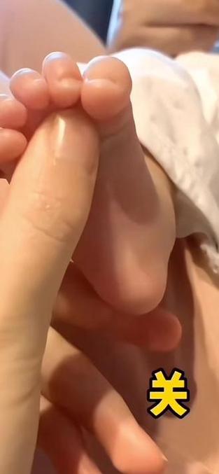 婴儿挠脚心没反应