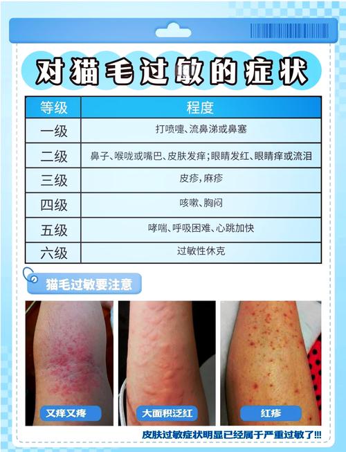 养猫过敏原截图