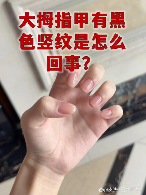 打印机出现一条黑色的横纹
