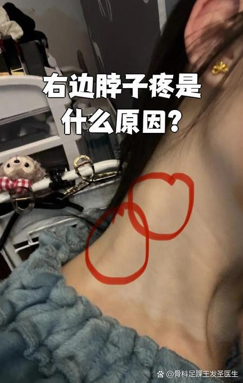 脖子右侧疼是什么前兆截图