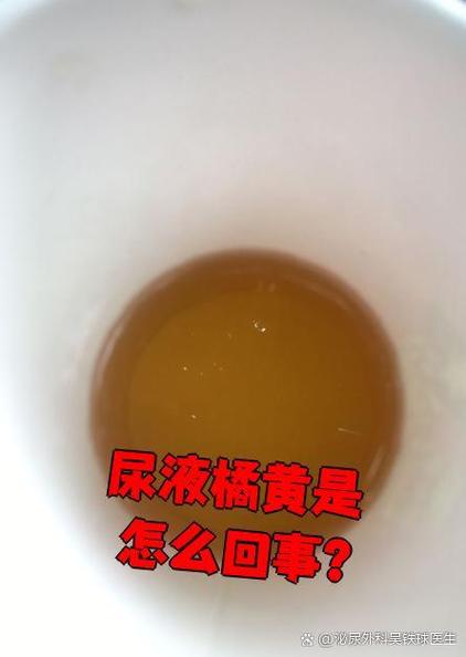 吃橘子为什么尿多
