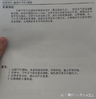 增强ct费用多少钱