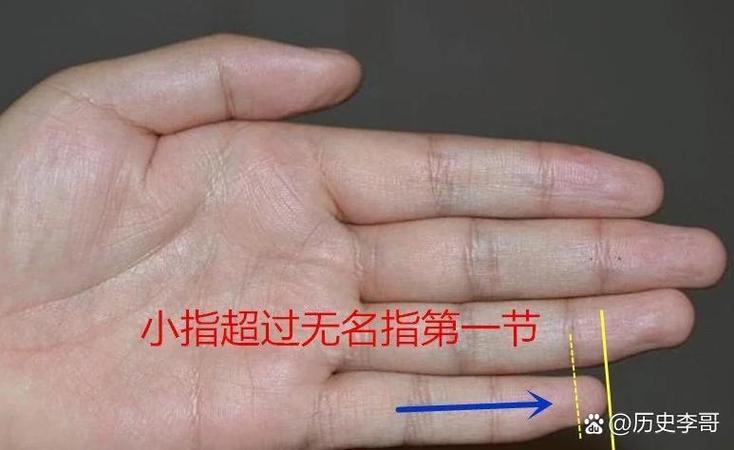 小拇指前面一根叫什么