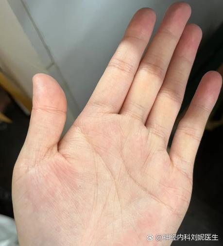 左胳膊发软无力是怎么回事