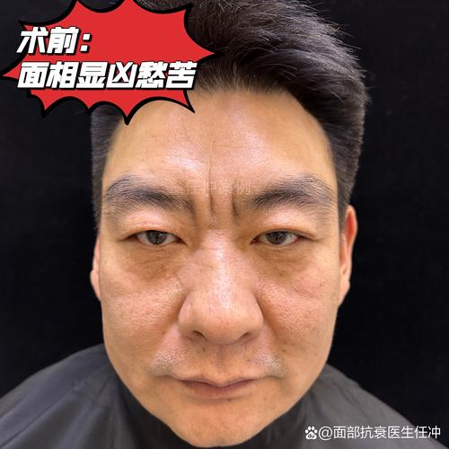 微信视频左右脸反转的解决方法