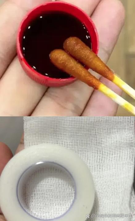 阴囊和大腿根部裂了一道口子