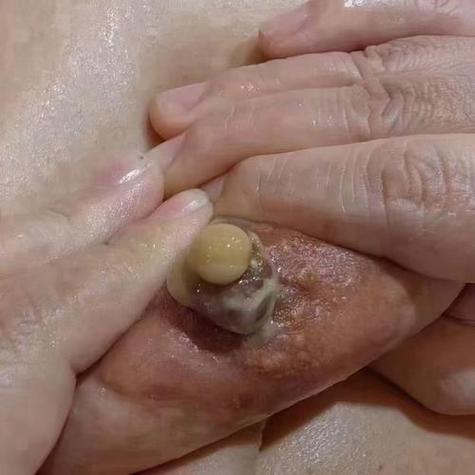 怎样排残奶最有效的方法