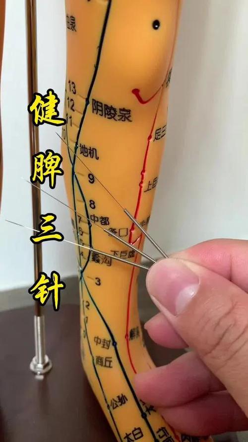 针灸的好处和坏处缩略图