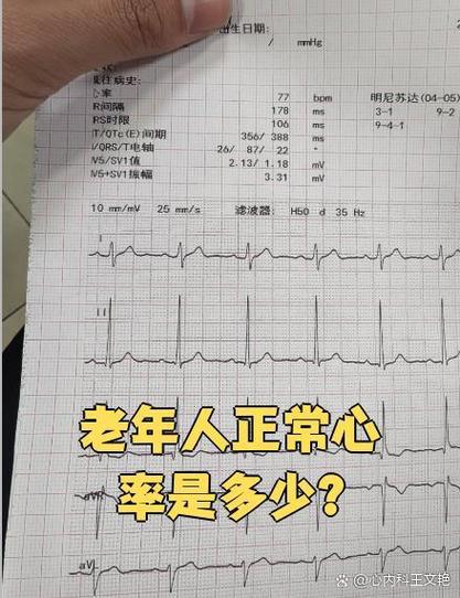 70-80岁心率55_60是正常吗图标
