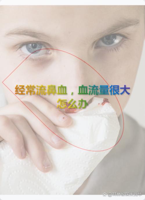 无故流鼻血是什么原因造成的游戏截图