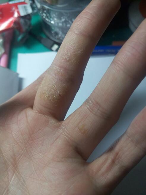 手机裂屏后裂口周围发黄