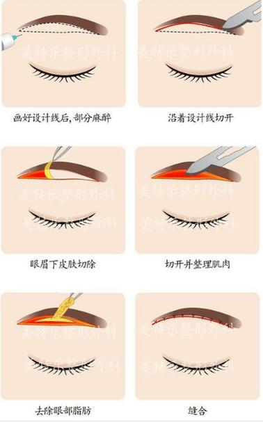 提眉三件套是什么意思截图