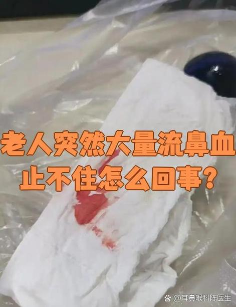 突然大量流鼻血止不住