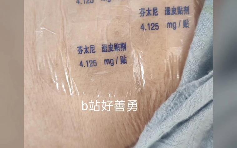 芬太尼透皮贴剂最多贴几个