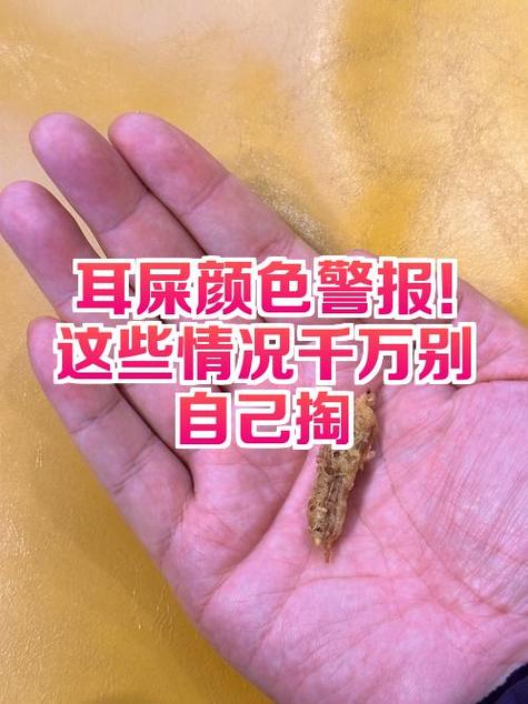 耳屎多久清理一次