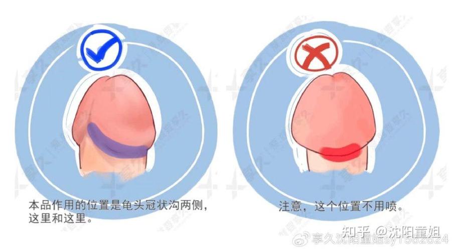 延时喷剂的正确使用方法截图