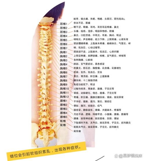 脊椎错位能自己复位不截图
