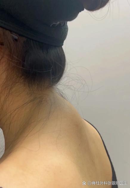 脖子后面骨头凸起怎么办图标