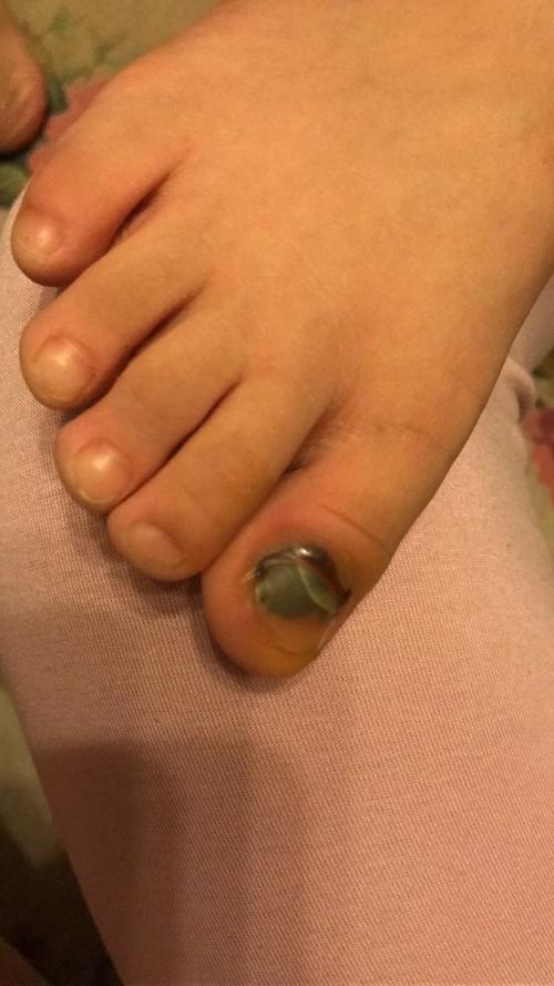 大脚伤害全程记录教程