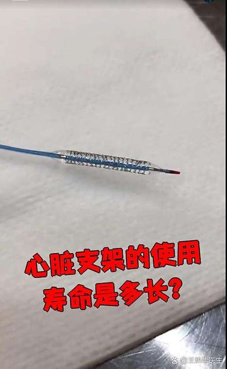 心脏支架的寿命是多少年截图