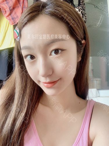 小眼睛已恢复,价格是原价怎么处理