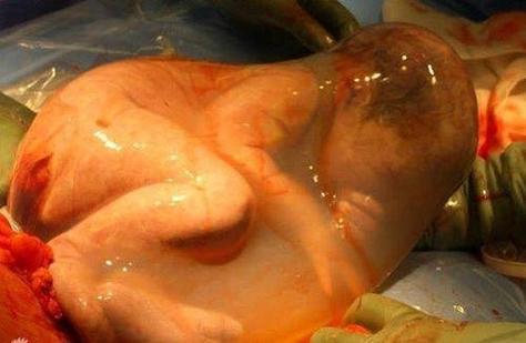 男人羊水破了生宝宝了
