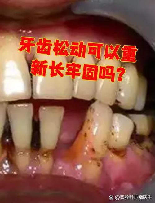 牙动了还能长牢固吗