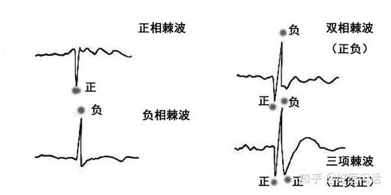 电波是什么意思