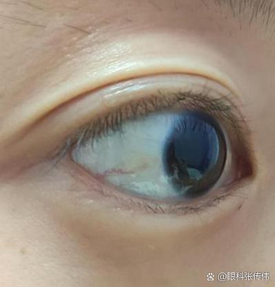 为什么白色眼球上脏脏的