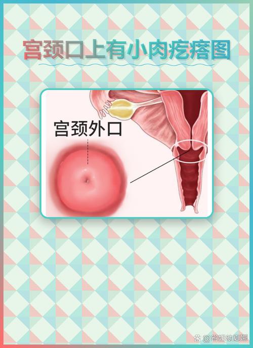 下体有紫红色肉