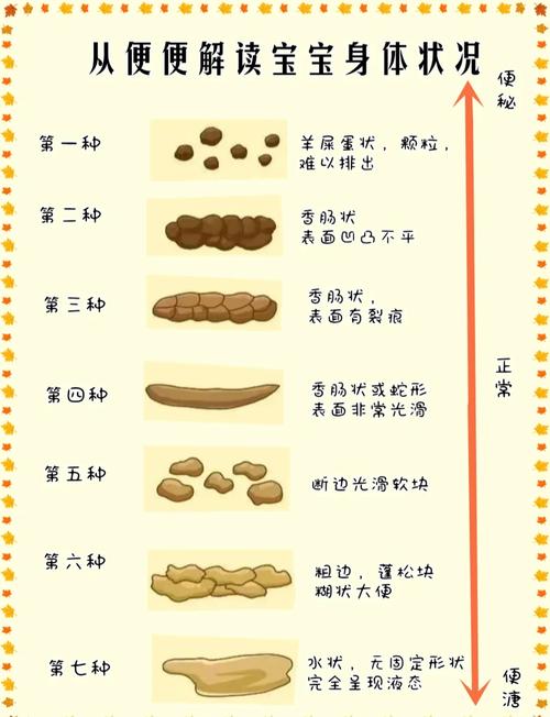 大便可以憋着吗