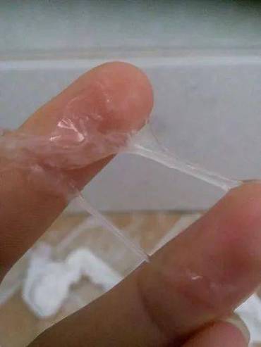 正常的白色分泌物是怎样的