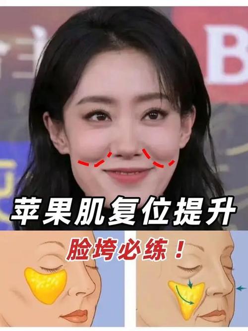 苹果肌提升多少钱缩略图