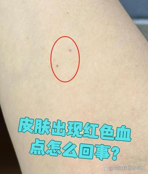 10种常见的小红点