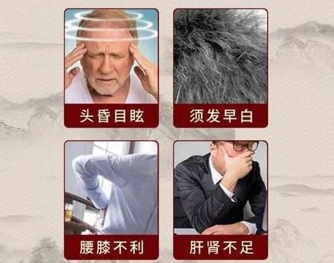 怎么判断是肾虚型白发