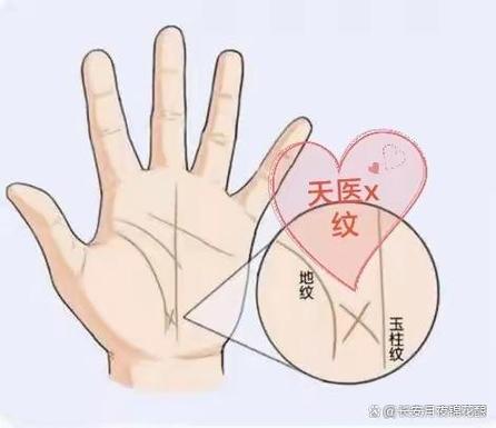 人一旦带天医就意味着什么