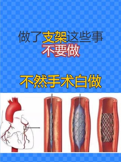做了支架手术禁忌什么截图