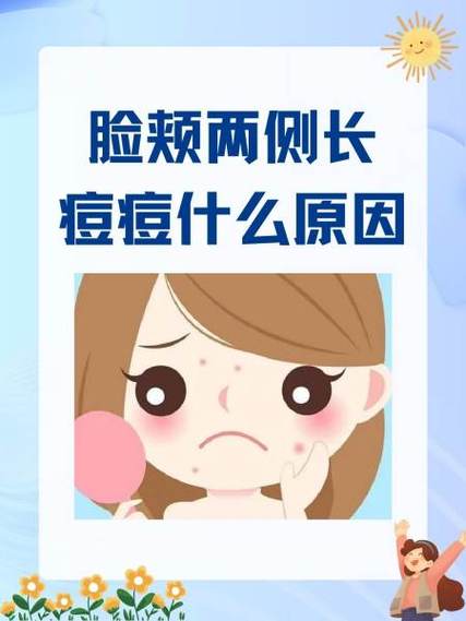 脸颊两边起痘的原因