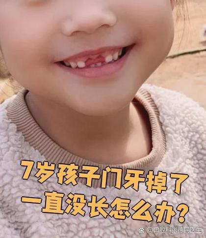 孩子换门牙旧牙不掉怎么办