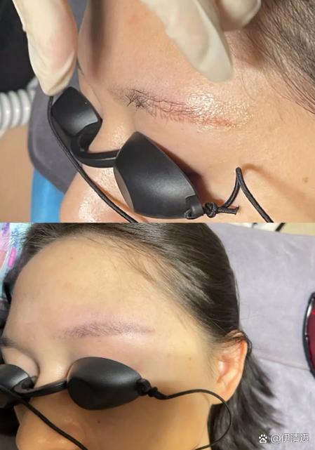 纹眉修复液不擦掉会怎样