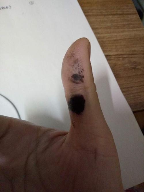 去钢笔水的有效办法