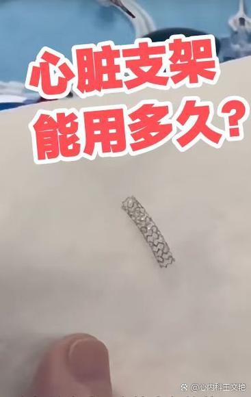 心脏支架几年换一次缩略图