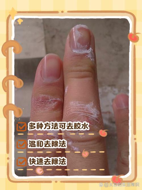 手上沾了万能胶怎么去除