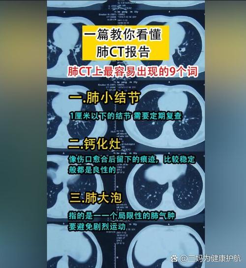 电子ct片可以保存多久